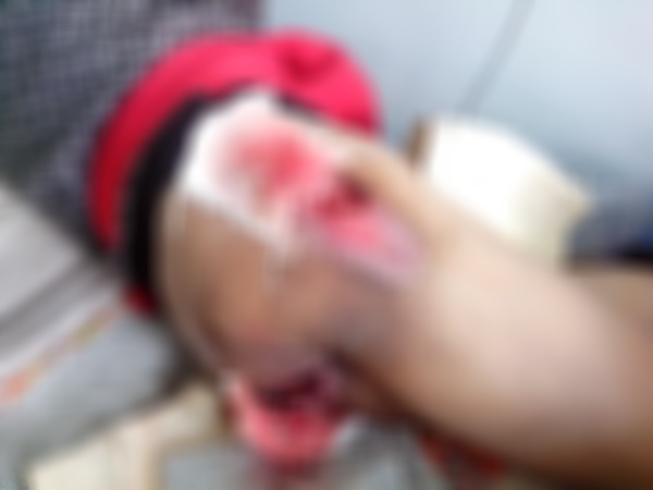 关于王玉超一家的爱心援助倡议书